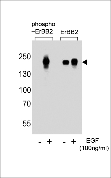 WB - Phospho-ErbB2(Y1112) Antibody AP3093a